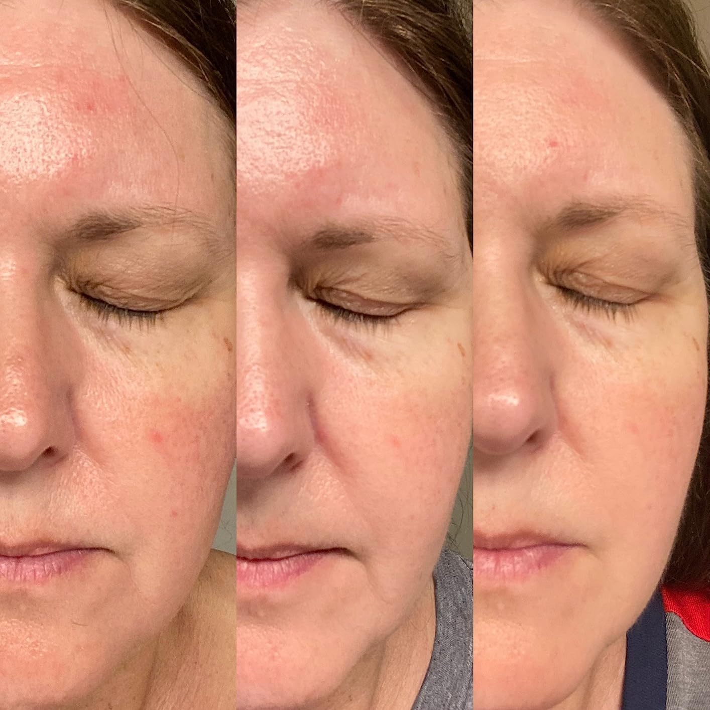 Customer photo — Makes a difference even after six weeks!